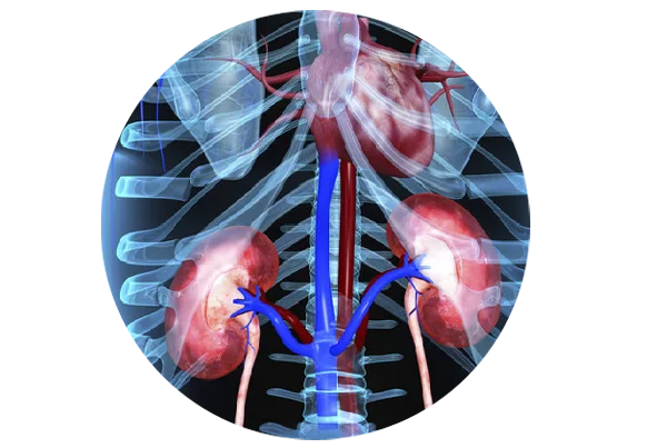 Renal Artery Stenting