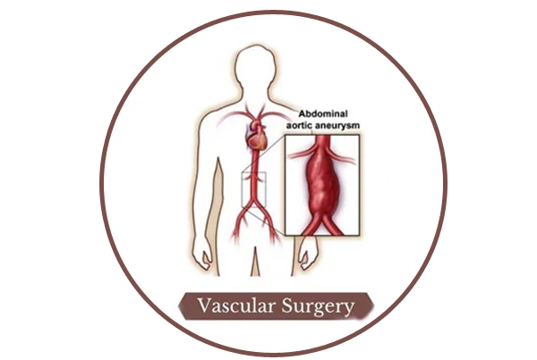 Vascular Surgery